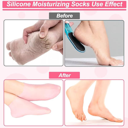 SILICON SOCKS
