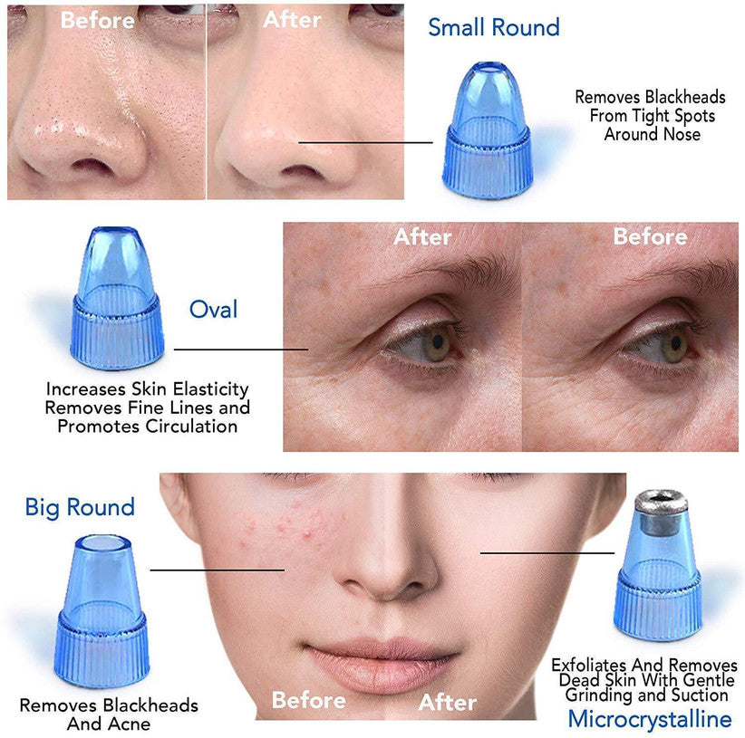 DERMA SUCTION