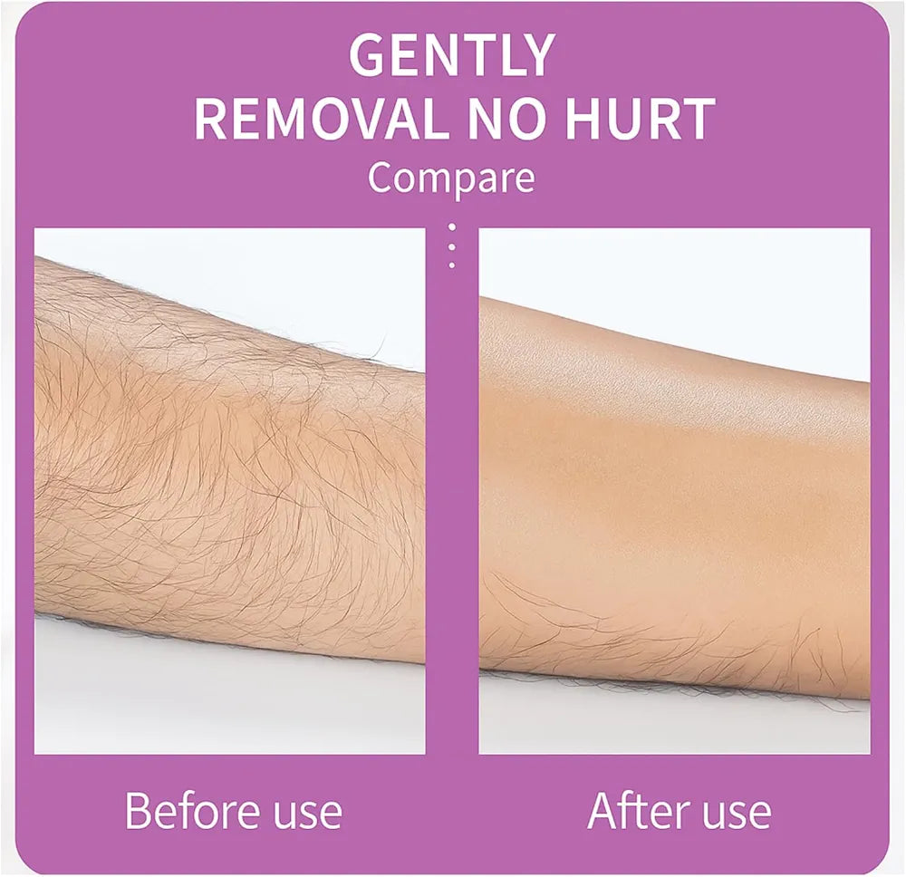 EPILATOR Hair Removal